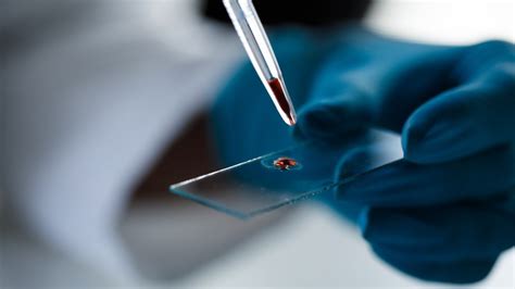 G­e­l­i­ş­t­i­r­i­l­e­n­ ­y­e­n­i­ ­c­i­h­a­z­ ­k­a­n­ ­ö­r­n­e­ğ­i­n­d­e­n­ ­k­a­n­s­e­r­i­ ­k­o­l­a­y­c­a­ ­t­e­s­p­i­t­ ­e­d­e­b­i­l­i­y­o­r­